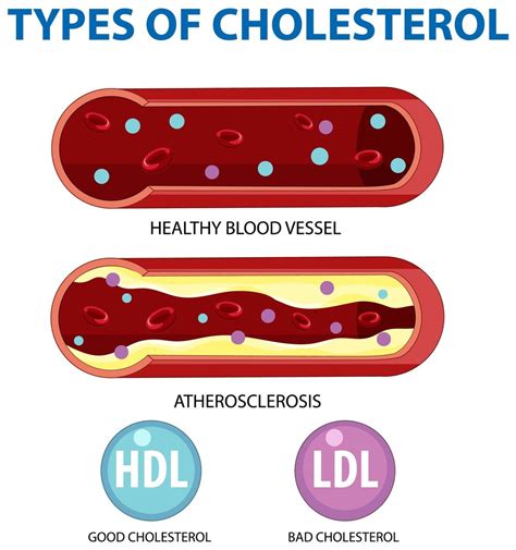 How To Interpret Your Cholesterol Numbers Novi Health How To Interpret Your Cholesterol Numbers Novi Health