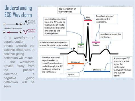 Simple Ecg Circuit Diagram Ecg Waveform Explained Ekg Label Simple Ecg Circuit Diagram Ecg Waveform Explained Ekg Label