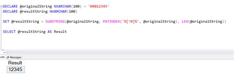 5 Ways Trim SQL Zeros